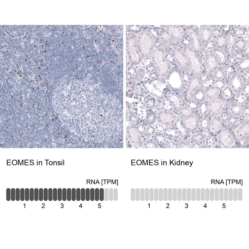 EOMES Antibody (CL15426) [Unconjugated] Immunohistochemistry-Paraffin: EOMES Antibody (CL15426) [NBP3-43668]