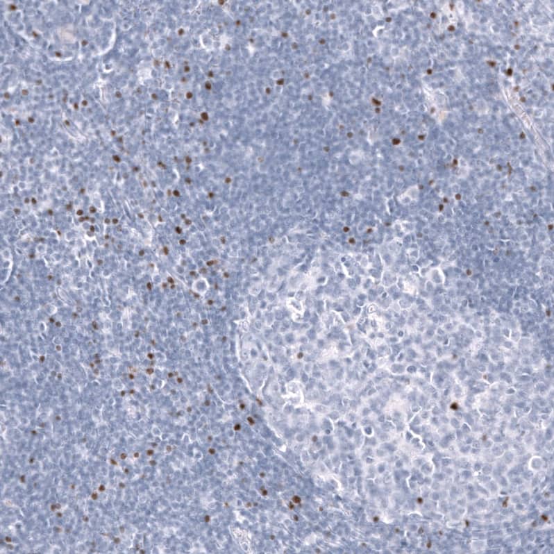 EOMES Antibody (CL15426) [Unconjugated] Immunohistochemistry-Paraffin: EOMES Antibody (CL15426) [NBP3-43668]