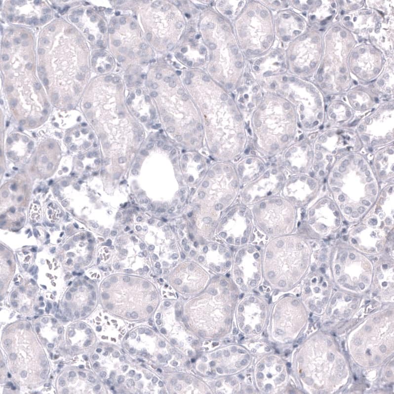 EOMES Antibody (CL15426) [Unconjugated] Immunohistochemistry-Paraffin: EOMES Antibody (CL15426) [NBP3-43668]