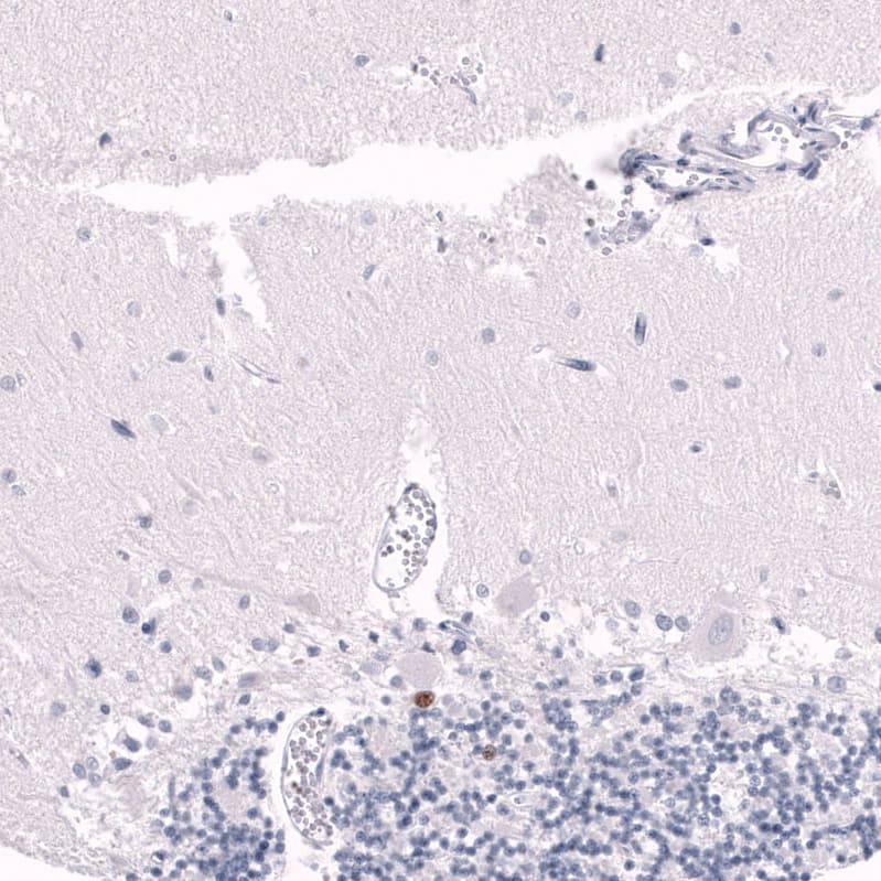 EOMES Antibody (CL15426) [Unconjugated] Immunohistochemistry-Paraffin: EOMES Antibody (CL15426) [NBP3-43668]