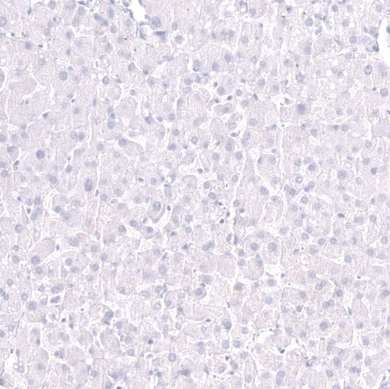 EOMES Antibody (CL15426) [Unconjugated] Immunohistochemistry-Paraffin: EOMES Antibody (CL15426) [NBP3-43668]
