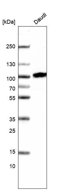 CD19 Antibody (CL15454) [Unconjugated] Western blot: CD19 Antibody (CL15454) [NBP3-43669]