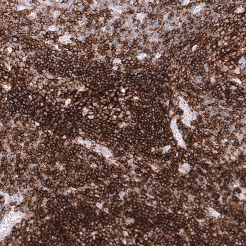 CD19 Antibody (CL15454) [Unconjugated] Immunohistochemistry-Paraffin: CD19 Antibody (CL15454) [NBP3-43669]