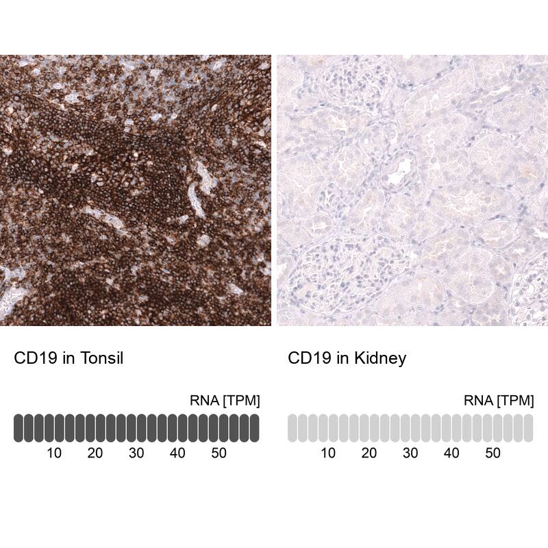 CD19 Antibody (CL15454) [Unconjugated] Immunohistochemistry-Paraffin: CD19 Antibody (CL15454) [NBP3-43669]