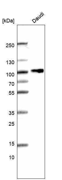 CD19 Antibody (CL15459) [Unconjugated] Western blot: CD19 Antibody (CL15459) [NBP3-43670]