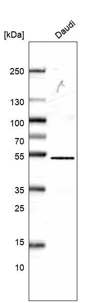 CD27/TNFRSF7 Antibody (CL15464) [Unconjugated] Western blot: CD27/TNFRSF7 Antibody (CL15464) [NBP3-43671]