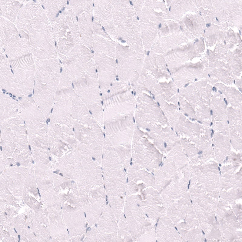 CD27/TNFRSF7 Antibody (CL15464) [Unconjugated] Immunohistochemistry-Paraffin: CD27/TNFRSF7 Antibody (CL15464) [NBP3-43671]