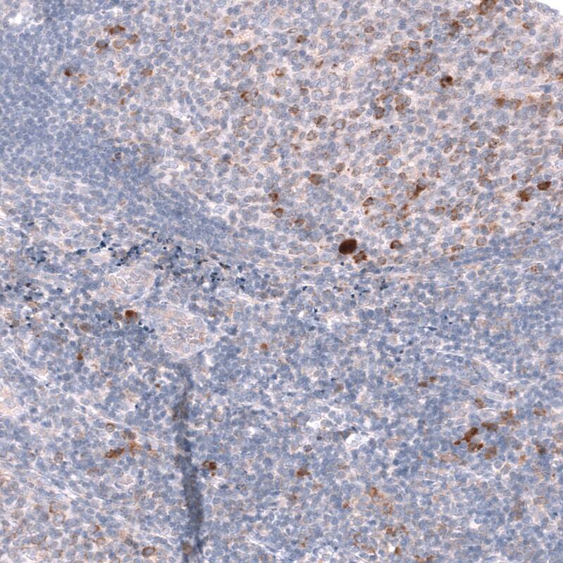CD27/TNFRSF7 Antibody (CL15464) [Unconjugated] Immunohistochemistry-Paraffin: CD27/TNFRSF7 Antibody (CL15464) [NBP3-43671]