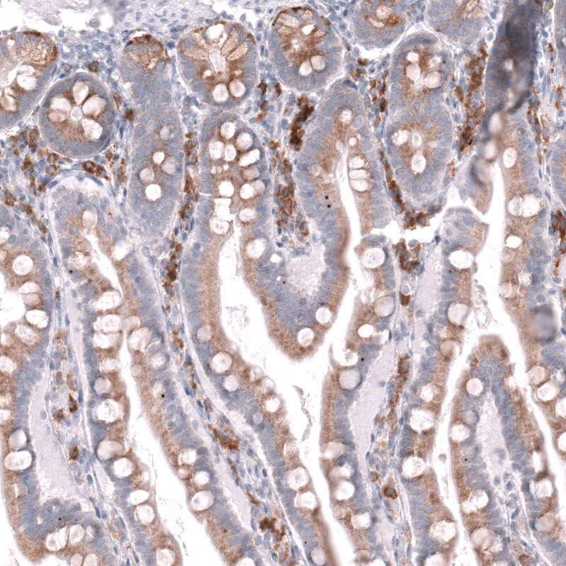 CD27/TNFRSF7 Antibody (CL15464) [Unconjugated] Immunohistochemistry-Paraffin: CD27/TNFRSF7 Antibody (CL15464) [NBP3-43671]