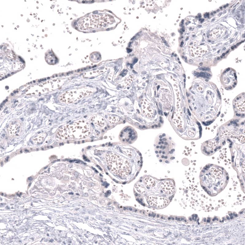 CLEC10A/CD301 Antibody (CL15513) [Unconjugated] Immunohistochemistry-Paraffin: CLEC10A/CD301 Antibody (CL15513) [NBP3-43672]