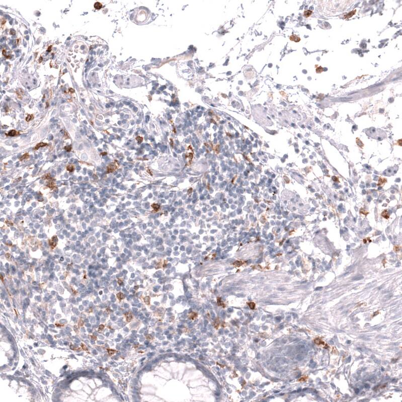 CLEC10A/CD301 Antibody (CL15513) [Unconjugated] Immunohistochemistry-Paraffin: CLEC10A/CD301 Antibody (CL15513) [NBP3-43672]