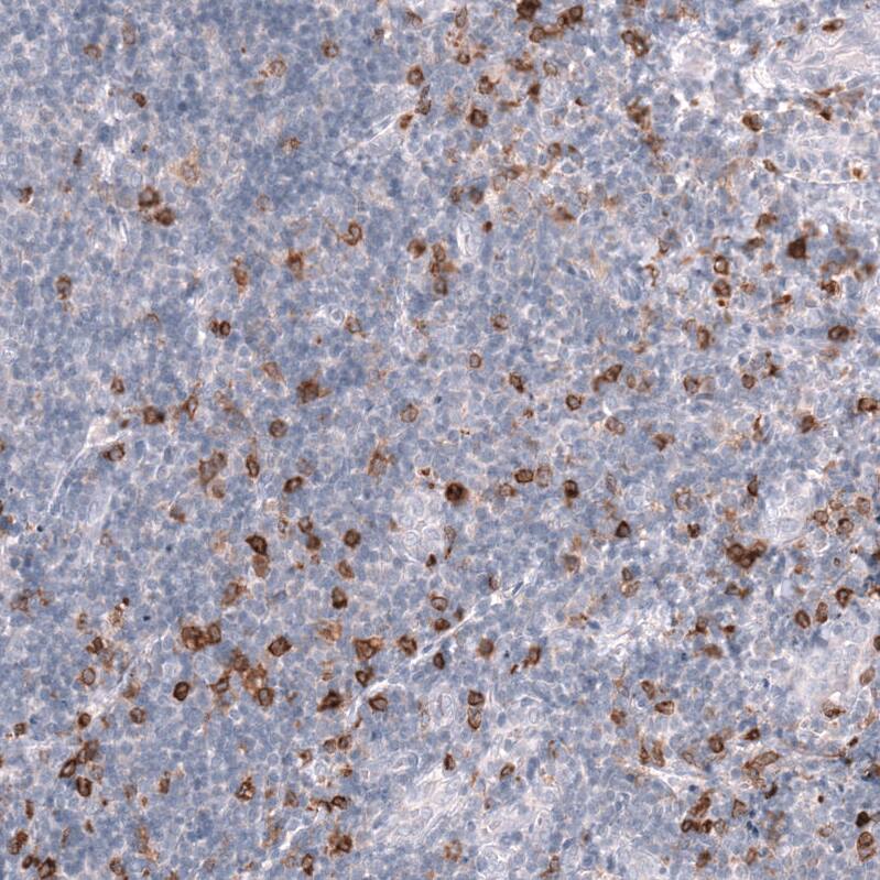 CLEC10A/CD301 Antibody (CL15513) [Unconjugated] Immunohistochemistry-Paraffin: CLEC10A/CD301 Antibody (CL15513) [NBP3-43672]