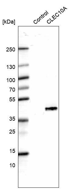 CLEC10A/CD301 Antibody (CL15523) [Unconjugated] Western blot: CLEC10A/CD301 Antibody (CL15523) [NBP3-43673]