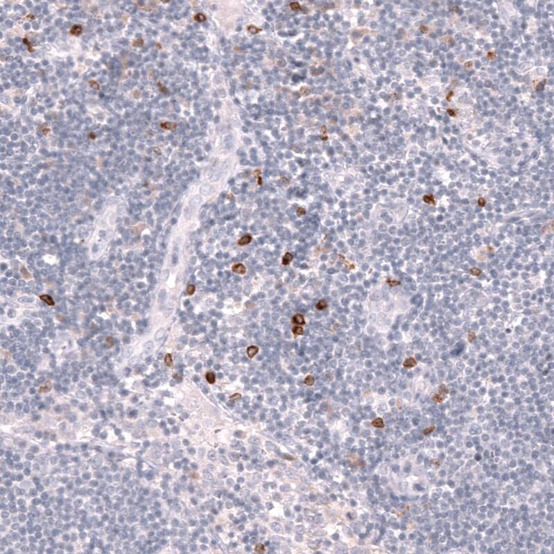 CLEC10A/CD301 Antibody (CL15523) [Unconjugated] Immunohistochemistry-Paraffin: CLEC10A/CD301 Antibody (CL15523) [NBP3-43673]