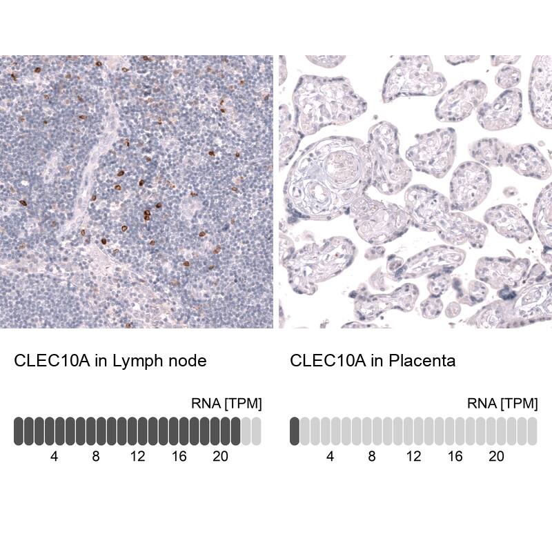 CLEC10A/CD301 Antibody (CL15523) [Unconjugated] Immunohistochemistry-Paraffin: CLEC10A/CD301 Antibody (CL15523) [NBP3-43673]
