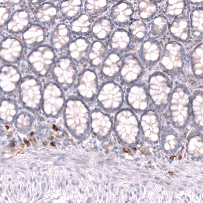 CLEC10A/CD301 Antibody (CL15523) [Unconjugated] Immunohistochemistry-Paraffin: CLEC10A/CD301 Antibody (CL15523) [NBP3-43673]