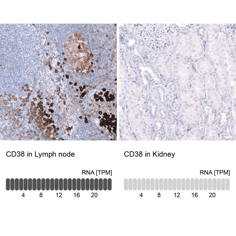 CD38 Antibody (CL15572) [Unconjugated] Immunohistochemistry-Paraffin: CD38 Antibody (CL15572) [NBP3-43674]