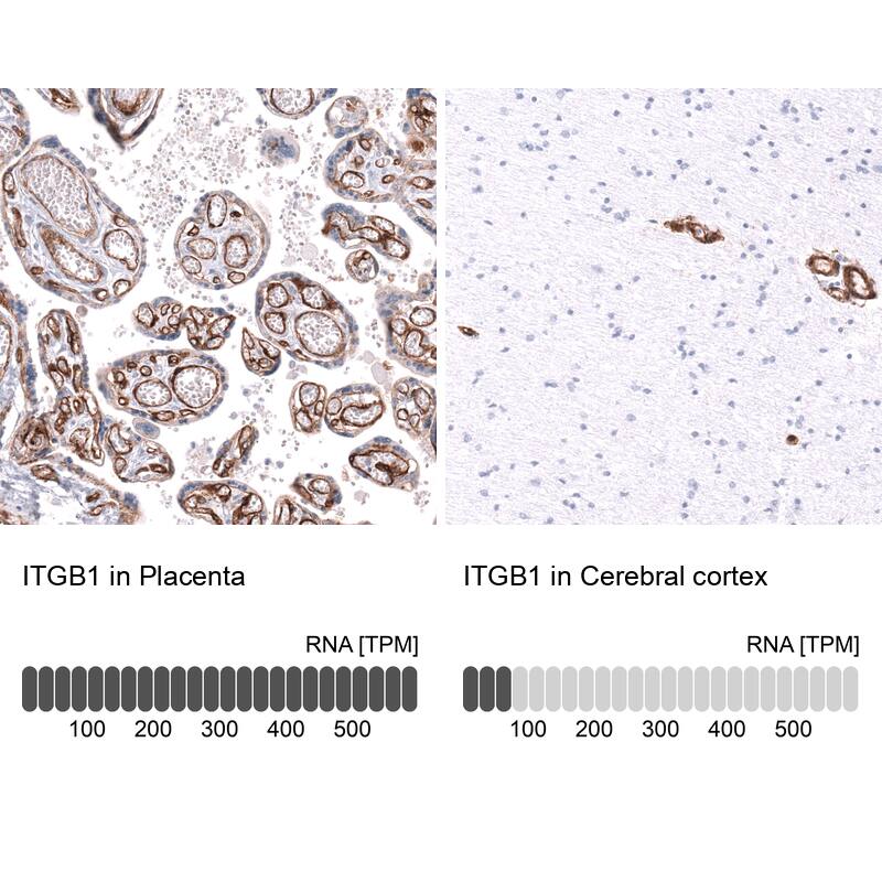 Integrin beta 1/CD29 Antibody (CL15606) [Unconjugated] Immunohistochemistry-Paraffin: Integrin beta 1/CD29 Antibody (CL15606) [NBP3-43675]
