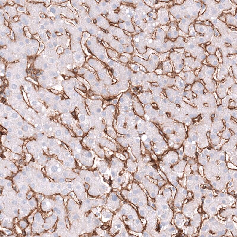 Integrin beta 1/CD29 Antibody (CL15606) [Unconjugated] Immunohistochemistry-Paraffin: Integrin beta 1/CD29 Antibody (CL15606) [NBP3-43675]