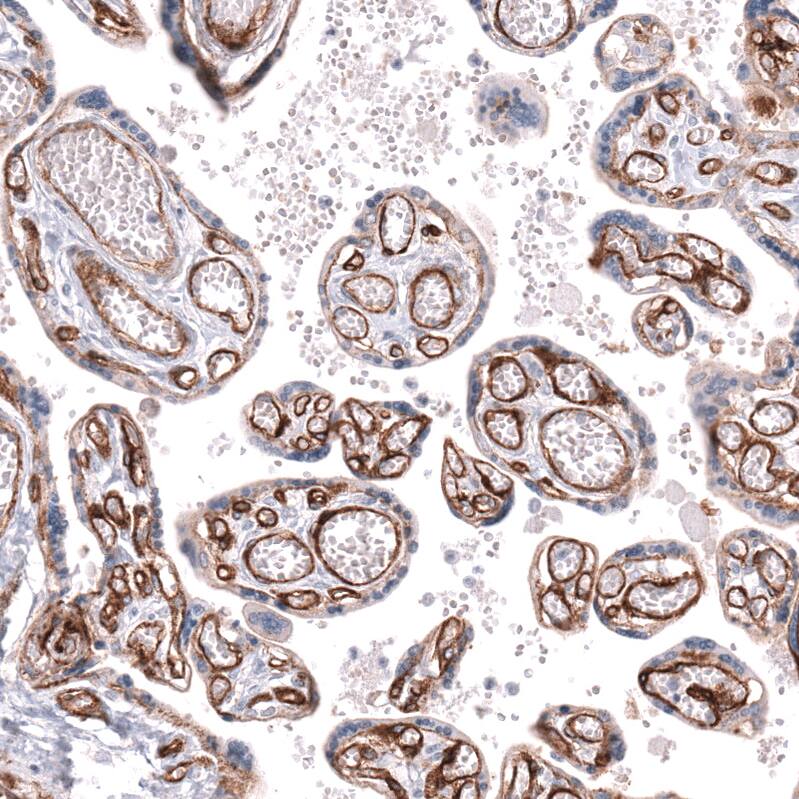 Integrin beta 1/CD29 Antibody (CL15606) [Unconjugated] Immunohistochemistry-Paraffin: Integrin beta 1/CD29 Antibody (CL15606) [NBP3-43675]