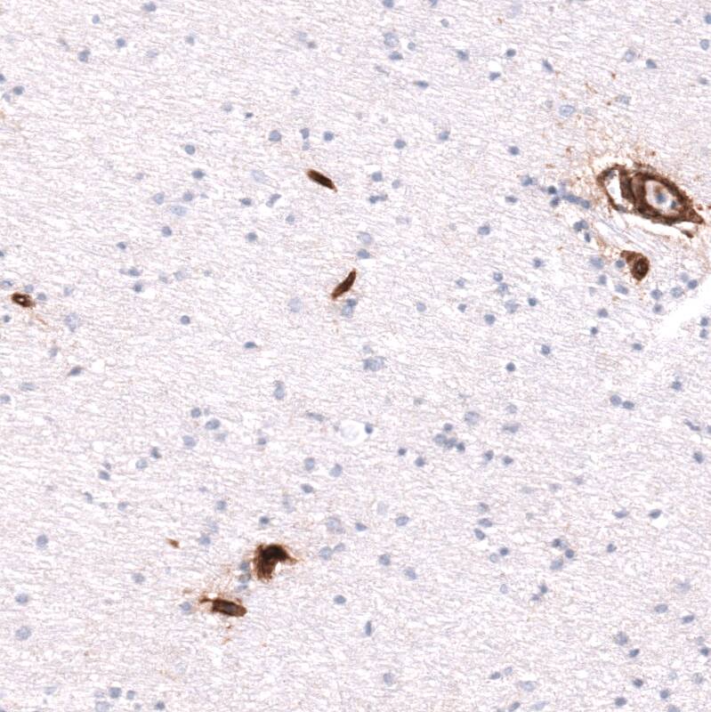 Integrin beta 1/CD29 Antibody (CL15622) [Unconjugated] Immunohistochemistry-Paraffin: Integrin beta 1/CD29 Antibody (CL15622) [NBP3-43676]