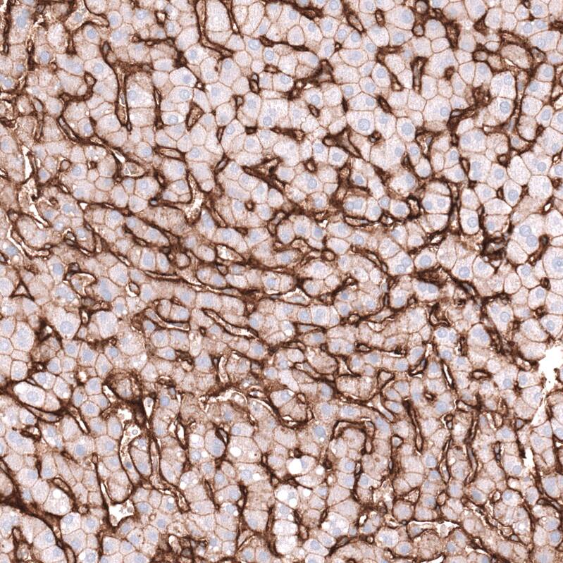 Integrin beta 1/CD29 Antibody (CL15622) [Unconjugated] Immunohistochemistry-Paraffin: Integrin beta 1/CD29 Antibody (CL15622) [NBP3-43676]