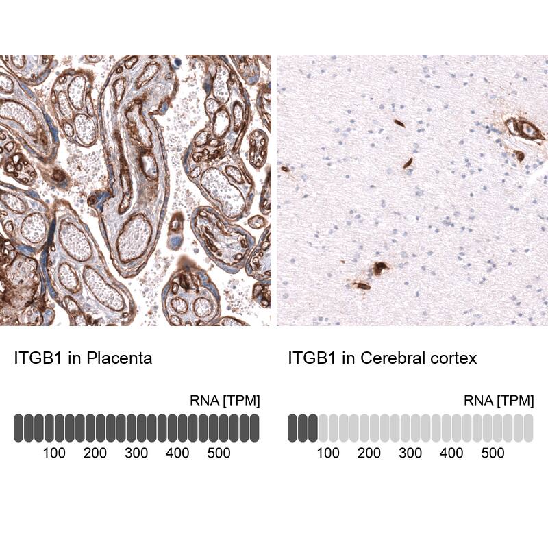Integrin beta 1/CD29 Antibody (CL15622) [Unconjugated] Immunohistochemistry-Paraffin: Integrin beta 1/CD29 Antibody (CL15622) [NBP3-43676]