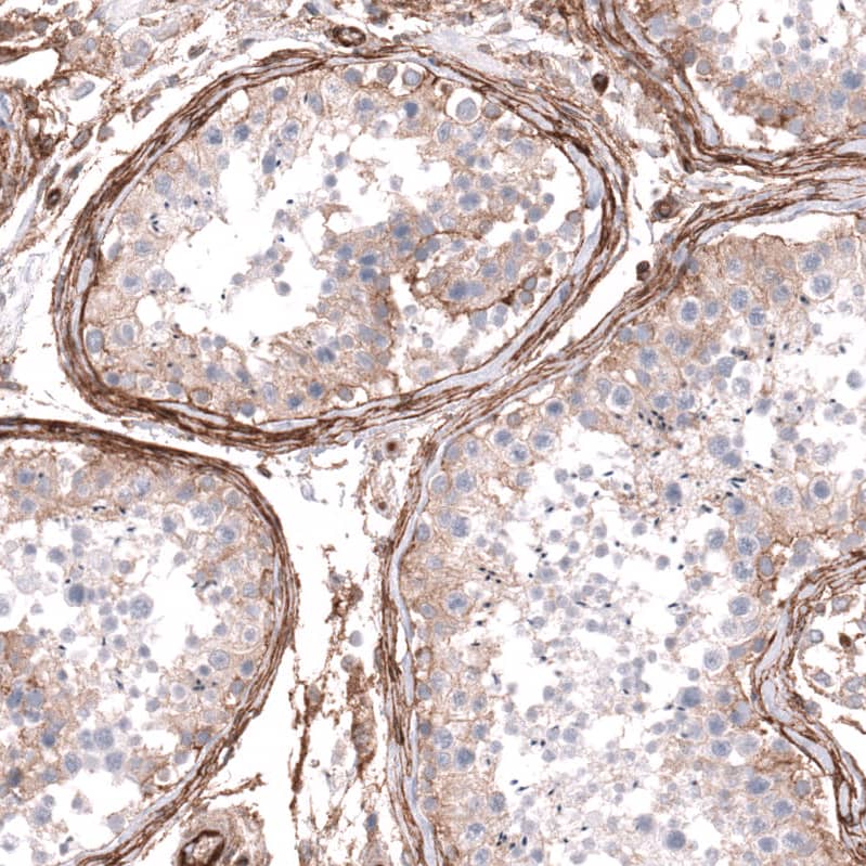Integrin beta 1/CD29 Antibody (CL15622) [Unconjugated] Immunohistochemistry-Paraffin: Integrin beta 1/CD29 Antibody (CL15622) [NBP3-43676]