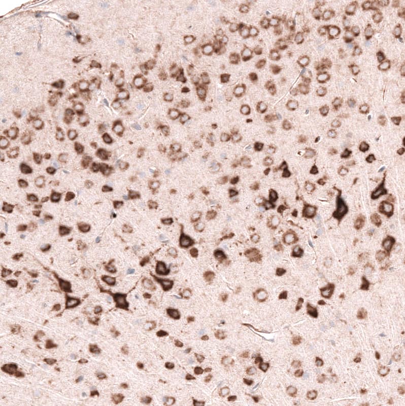 Pleiotrophin/PTN Antibody (CL15628) [Unconjugated] Immunohistochemistry-Paraffin: Pleiotrophin/PTN Antibody (CL15628) [NBP3-43677]