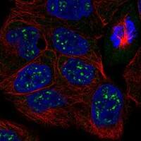 RADX Antibody [Unconjugated] - BSA Free Immunocytochemistry/ Immunofluorescence: RADX Antibody [Unconjugated] - BSA Free [NBP3-43678]