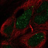 EBF-2 Antibody [Unconjugated] Immunocytochemistry/ Immunofluorescence : EBF-2 pAb [NBP3-43679]