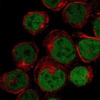 HOXB9 Antibody [Unconjugated] Immunocytochemistry/ Immunofluorescence : HOXB9 pAb [NBP3-43680]