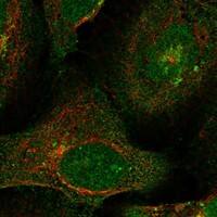 DOK2 Antibody [Unconjugated] Immunocytochemistry/ Immunofluorescence : DOK2 pAb [NBP3-43681]