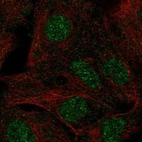 TBX18 Antibody [Unconjugated] Immunocytochemistry/ Immunofluorescence : TBX18 pAb [NBP3-43683]