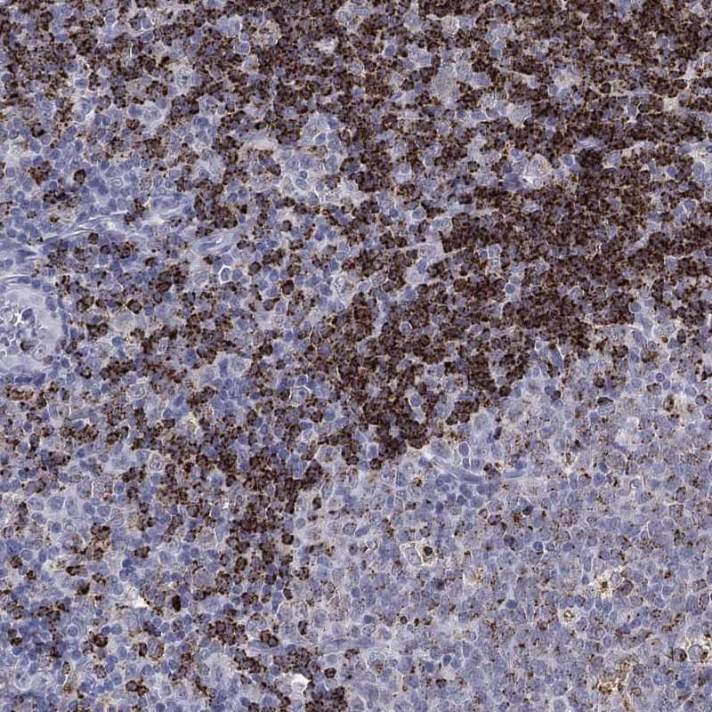 HLA DOA Antibody [Unconjugated] Immunohistochemistry-Paraffin: HLA DOA pAb [NBP3-43684]