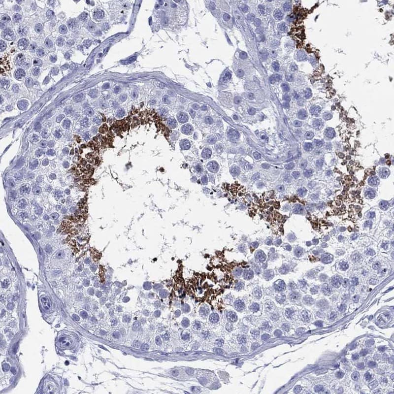 Cylicin 1 Antibody [Unconjugated] Immunohistochemistry-Paraffin: Cylicin 1 pAb [NBP3-43686]