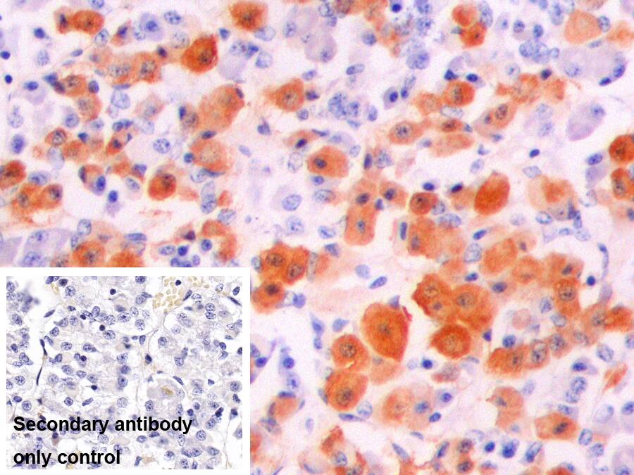 Alpha-Melanocyte Stimulating Hormone Antibody - BSA Free Alpha-Melanocyte Stimulating Hormone Antibody - BSA Free