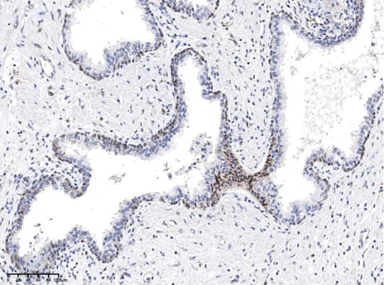Rabbit anti-Mouse IgG1 Secondary Antibody (20)
