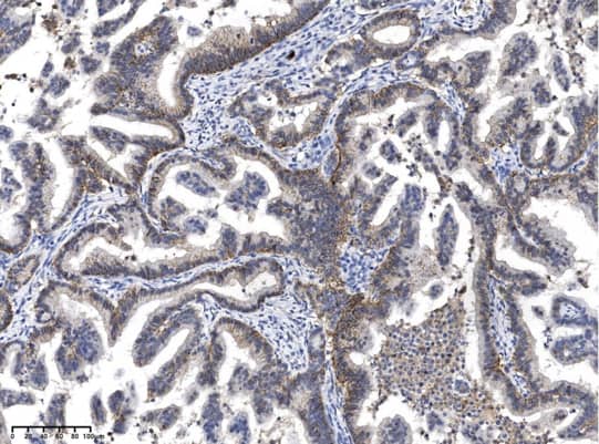 Rabbit anti-Mouse IgG1 Secondary Antibody (20)