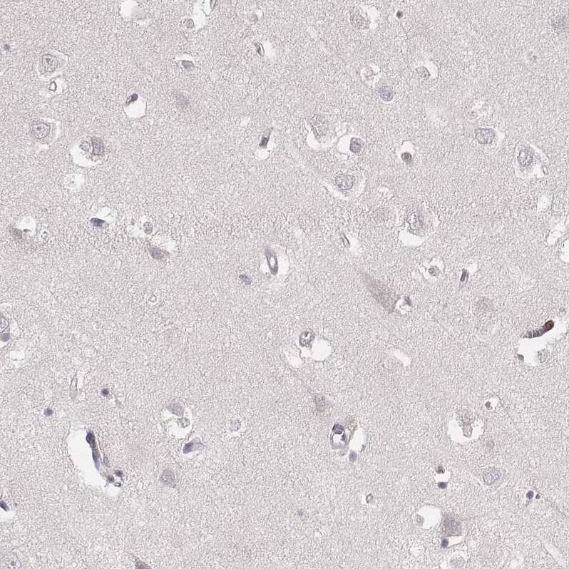 CD8 Antibody (CL1529) - Azide and BSA Free Immunohistochemistry-Paraffin: CD8 Antibody [NBP3-43780]