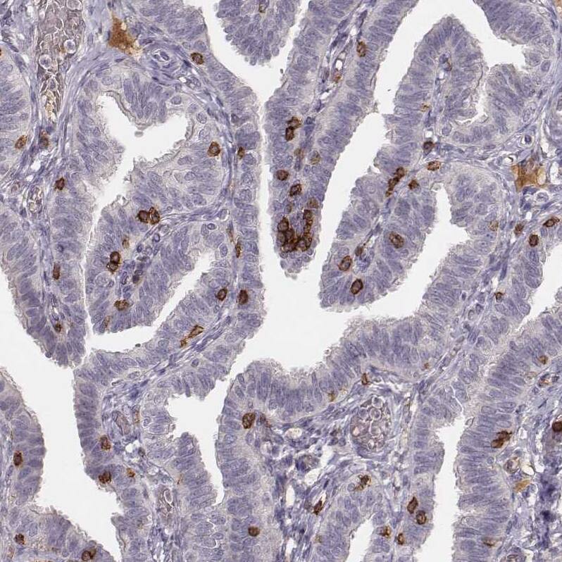CD8 Antibody (CL1529) - Azide and BSA Free Immunohistochemistry-Paraffin: CD8 Antibody [NBP3-43780]