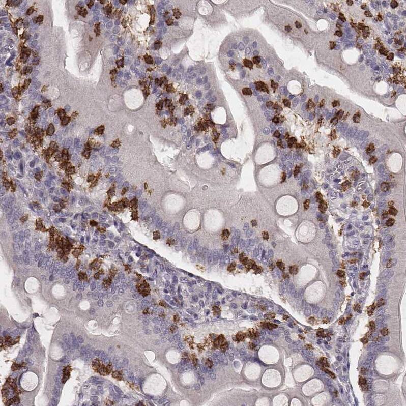 CD8 Antibody (CL1529) - Azide and BSA Free Immunohistochemistry-Paraffin: CD8 Antibody [NBP3-43780]