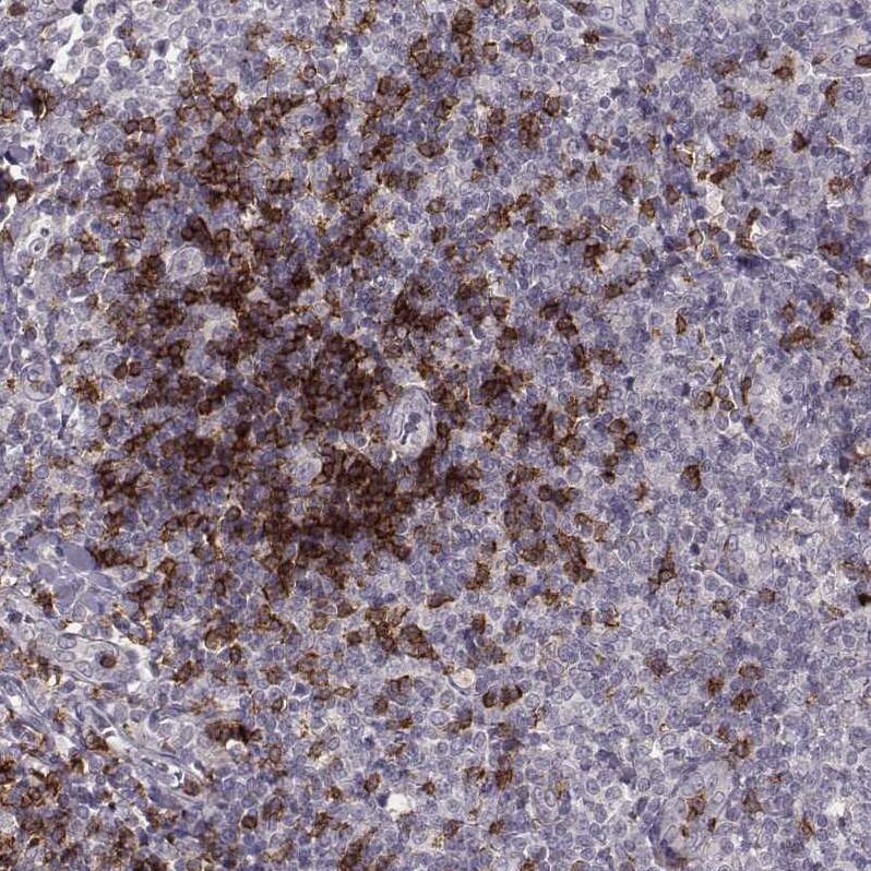 CD8 Antibody (CL1529) - Azide and BSA Free Immunohistochemistry-Paraffin: CD8 Antibody [NBP3-43780]