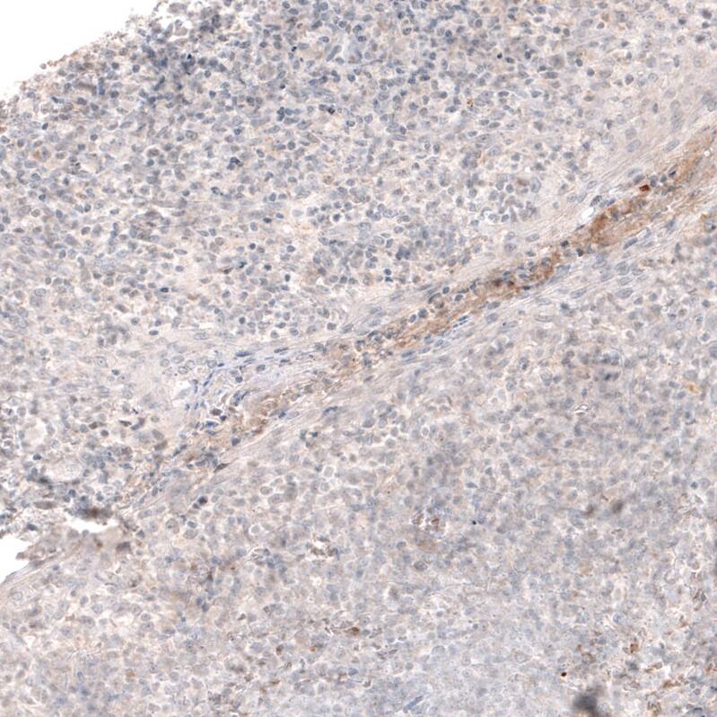 Laminin Antibody (CL2968) - Azide and BSA Free Immunohistochemistry-Paraffin: Laminin Antibody [NBP3-43781]