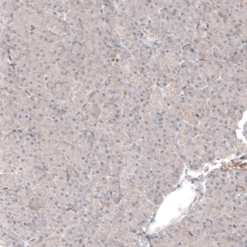 Laminin Antibody (CL2968) - Azide and BSA Free Immunohistochemistry-Paraffin: Laminin Antibody [NBP3-43781]