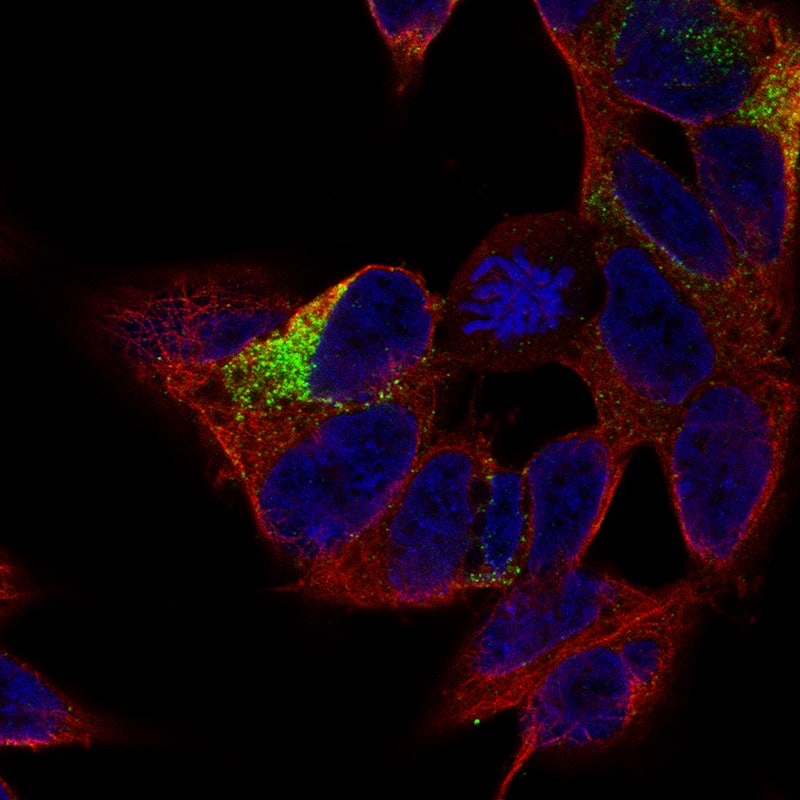 MAP2 Antibody (CL5420) - Azide and BSA Free Immunocytochemistry/ Immunofluorescence: MAP2 Antibody [NBP3-43783]