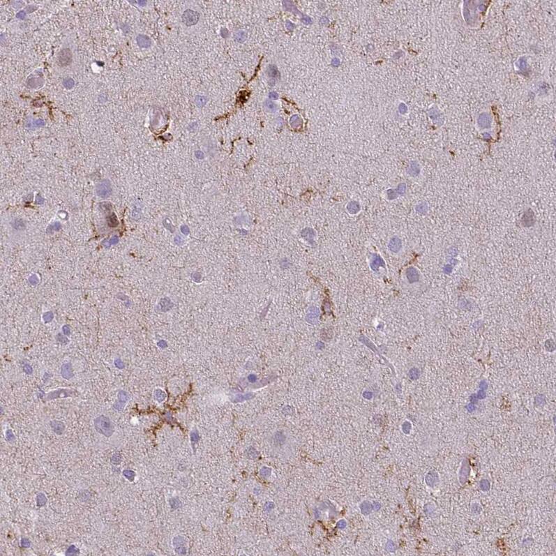 CD11b Antibody (CL1719) - Azide and BSA Free Immunohistochemistry-Paraffin: CD11b Antibody [NBP3-43784]