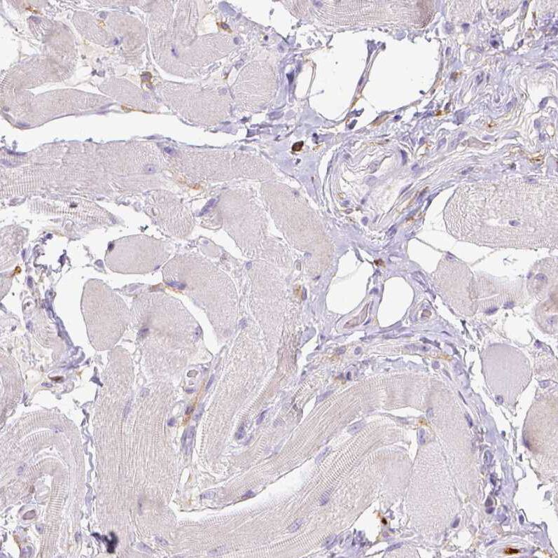 CD11b Antibody (CL1719) - Azide and BSA Free Immunohistochemistry-Paraffin: CD11b Antibody [NBP3-43784]