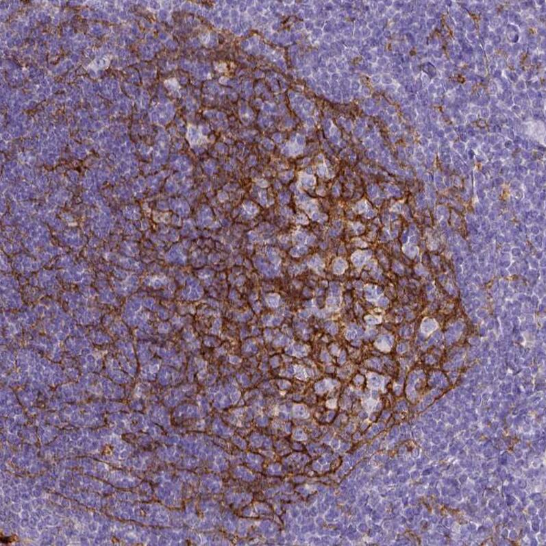 CD11b Antibody (CL1719) - Azide and BSA Free Immunohistochemistry-Paraffin: CD11b Antibody [NBP3-43784]