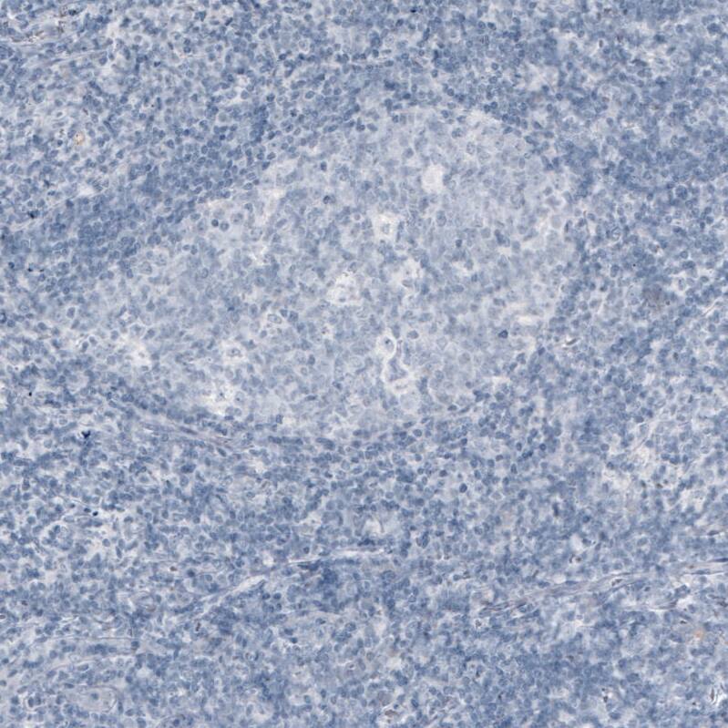 MOG Antibody (CL2858) - Azide and BSA Free Immunohistochemistry-Paraffin: MOG Antibody [NBP3-43786]